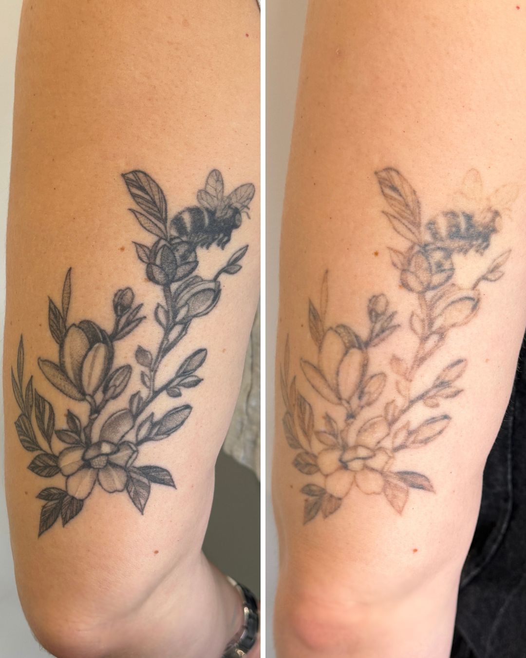 Floral forearm tattoo faded in three sessions.