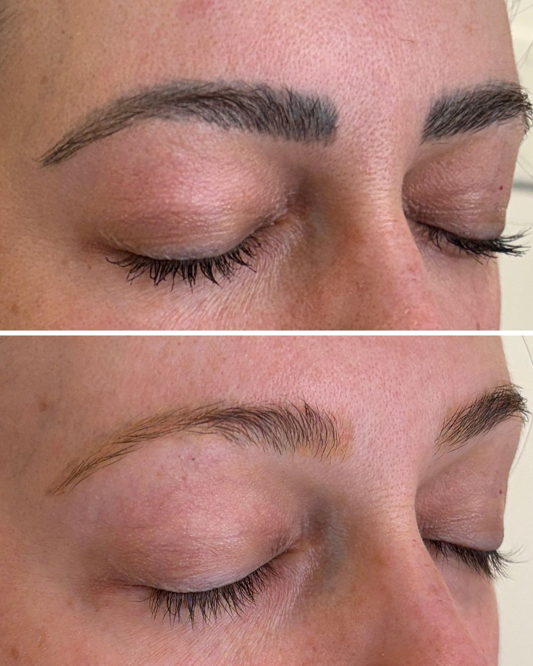 PMU brow removal before and after, significant fading after 1 session