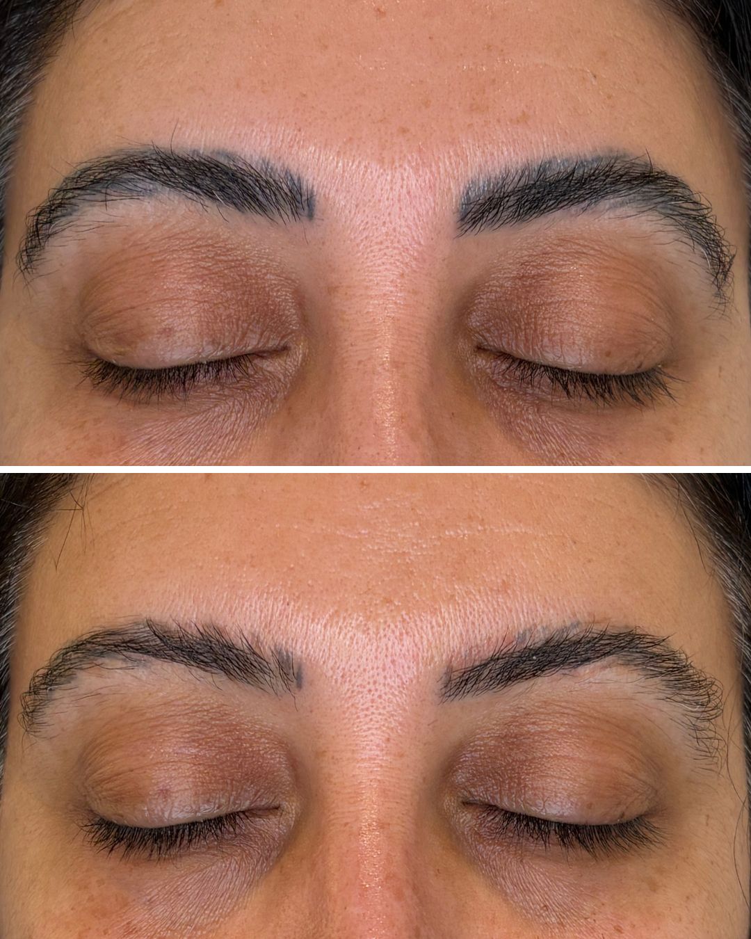 PMU brow removal before and after, significant fading after 1 session