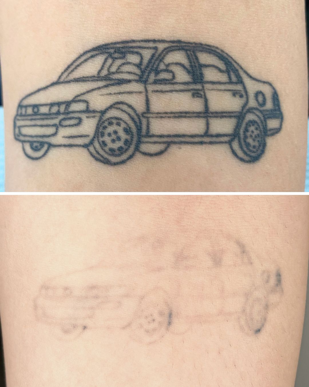 Car outline on the forearm faded to faint lines.