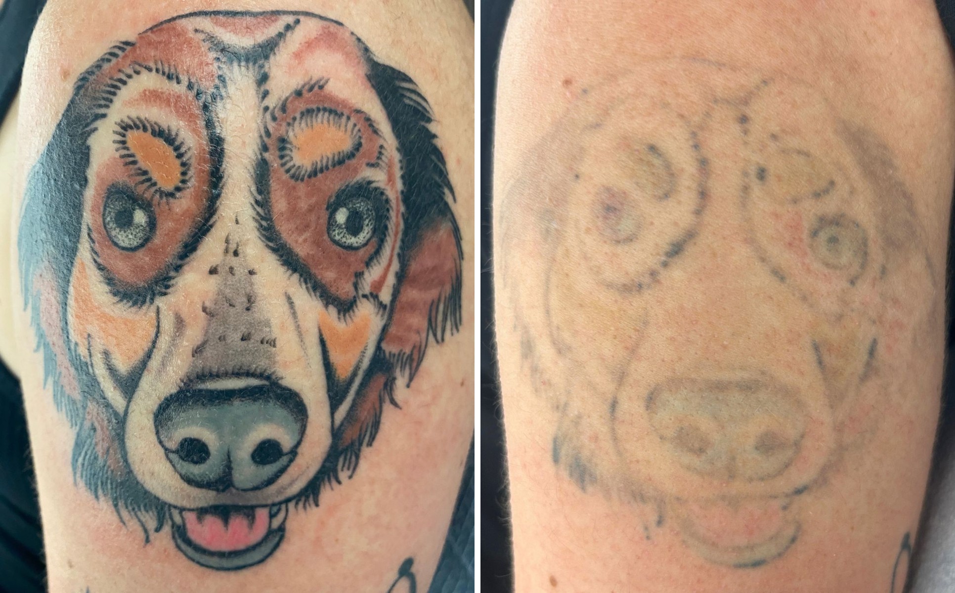 Full-colour portrait tattoo faded over ten sessions.