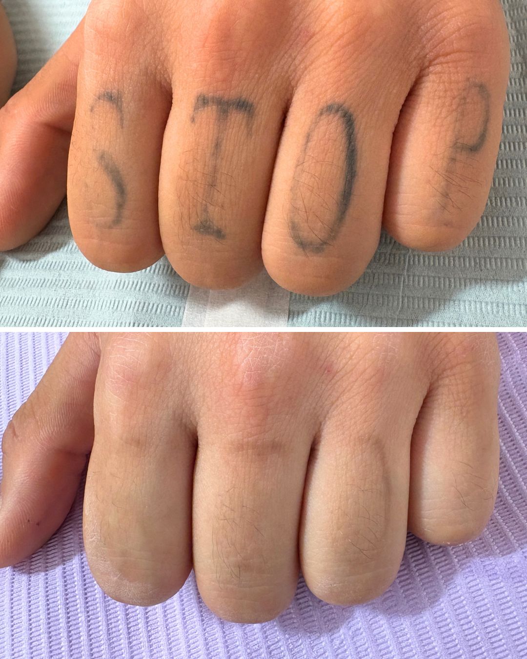 Knuckle lettering faded across five sessions.
