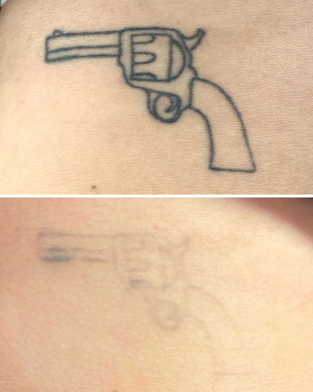 Revolver tattoo heavily faded over six sessions.