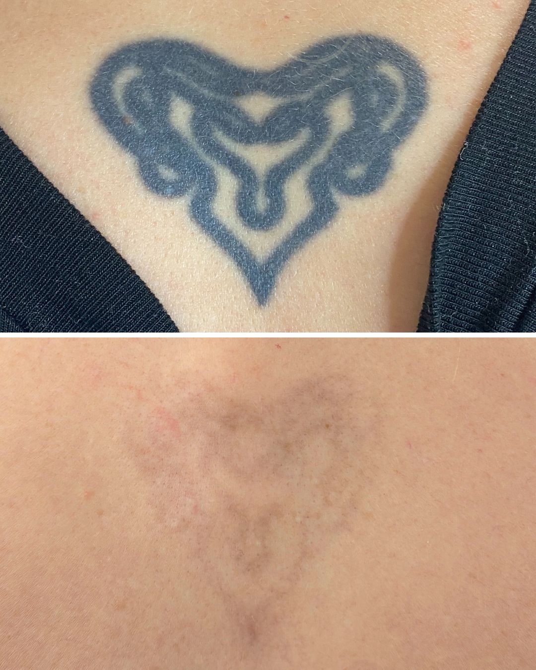 Dense chest piece broken down to a faint shadow.