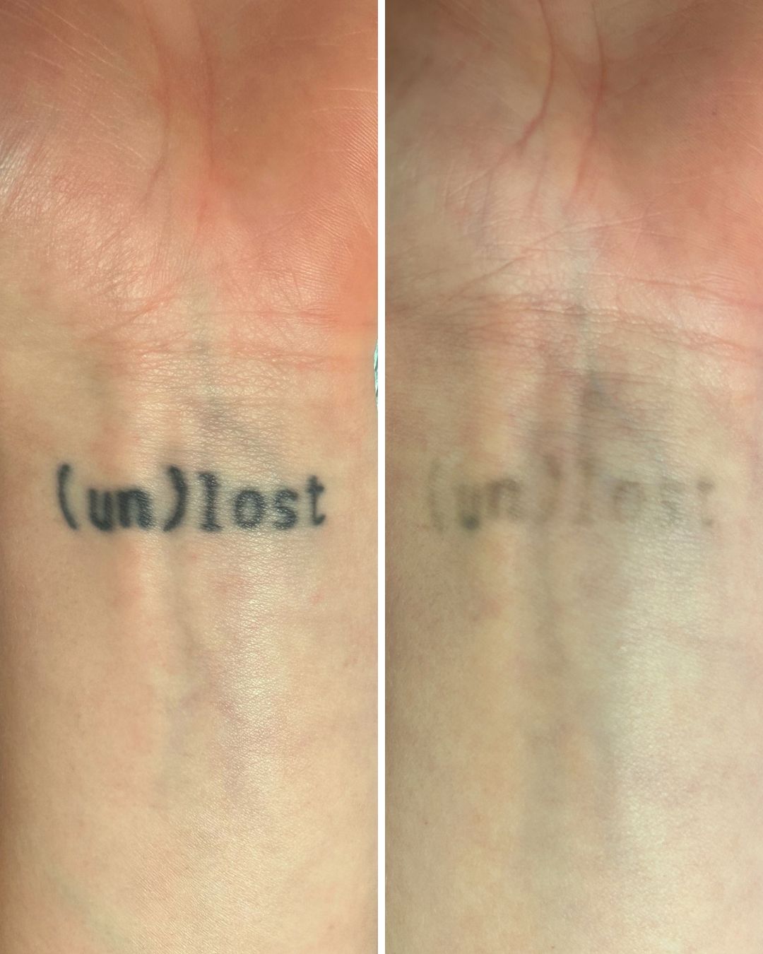 Wrist lettering faded to faint text.