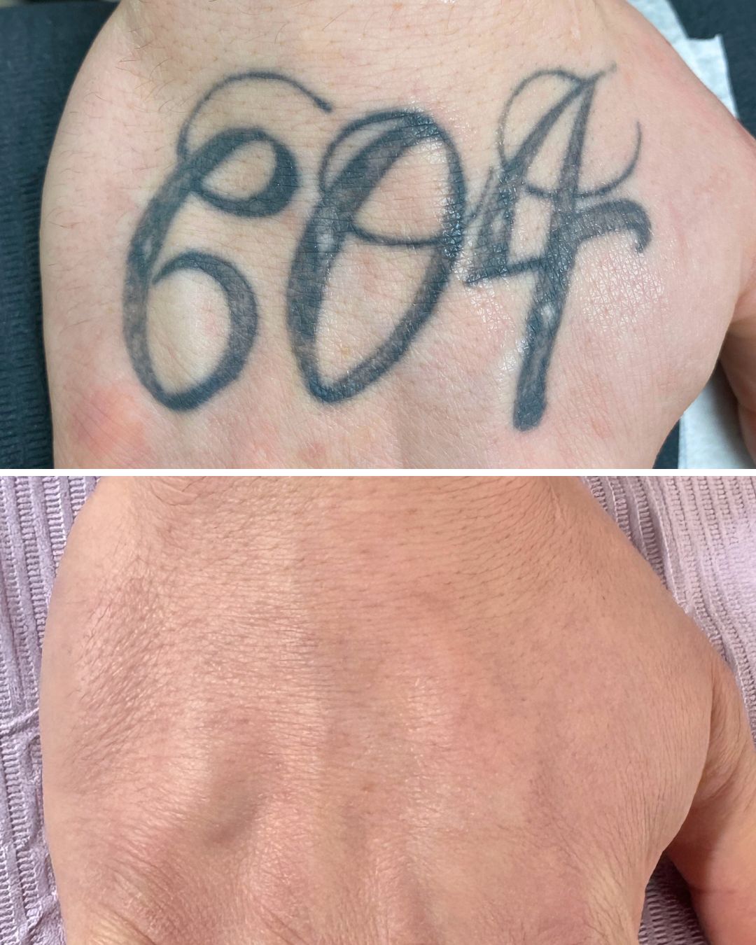 Hand lettering lifted almost completely clear.