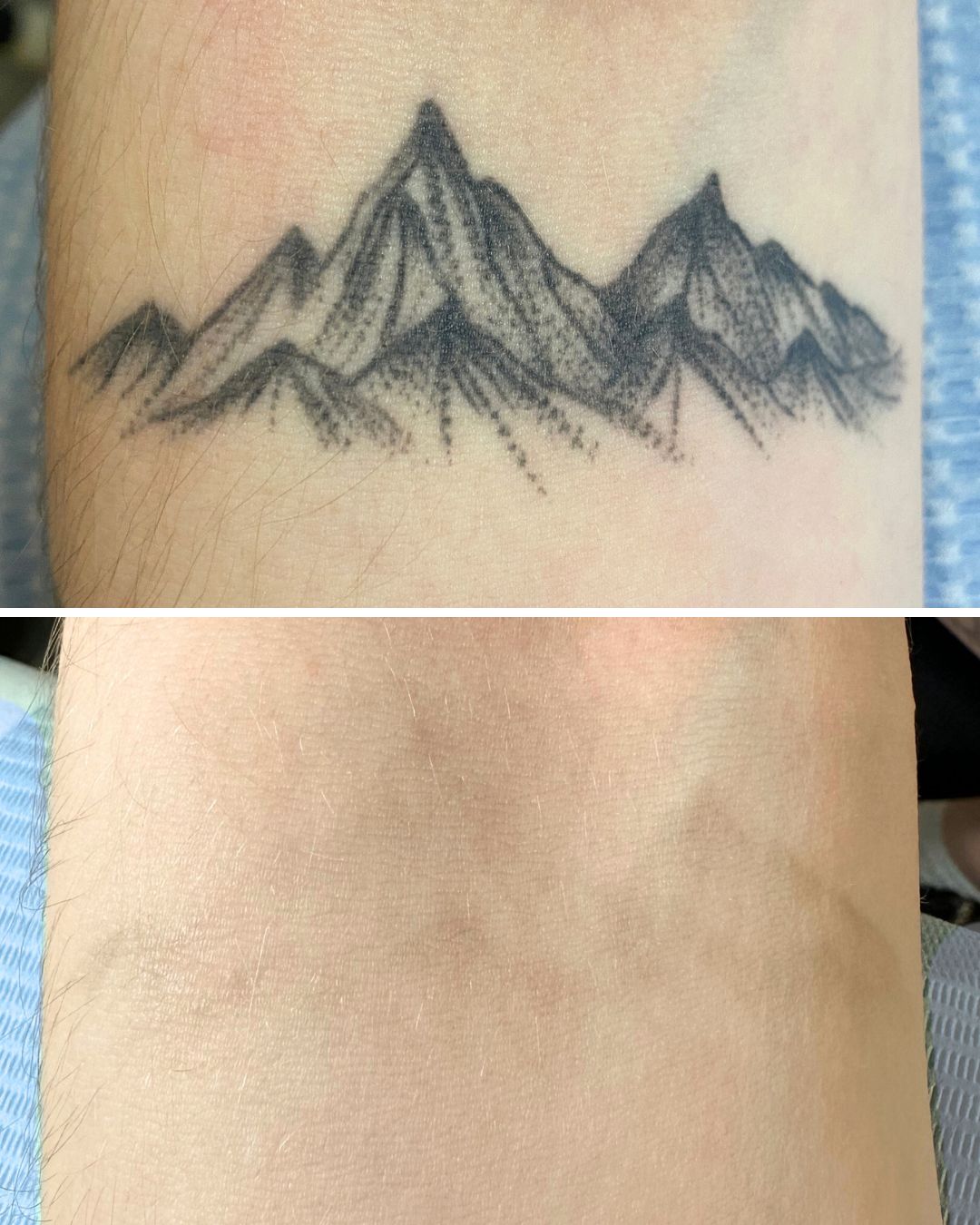 Mountain range on the forearm faded to faint lines.