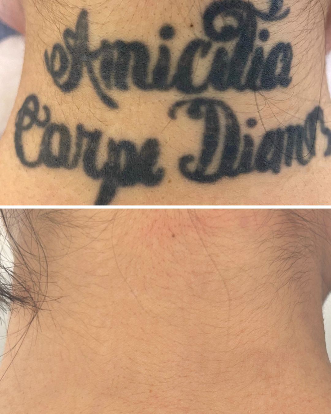 Large script across the neck, faded back to bare skin.